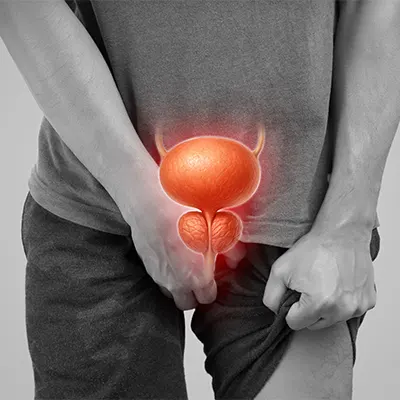 img-cirugia-laser-de-prostata-en-bogota-1-LCP